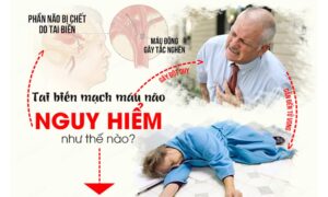 Sử dụng ghế massage Buheung rất tốt cho người bị tai biến.