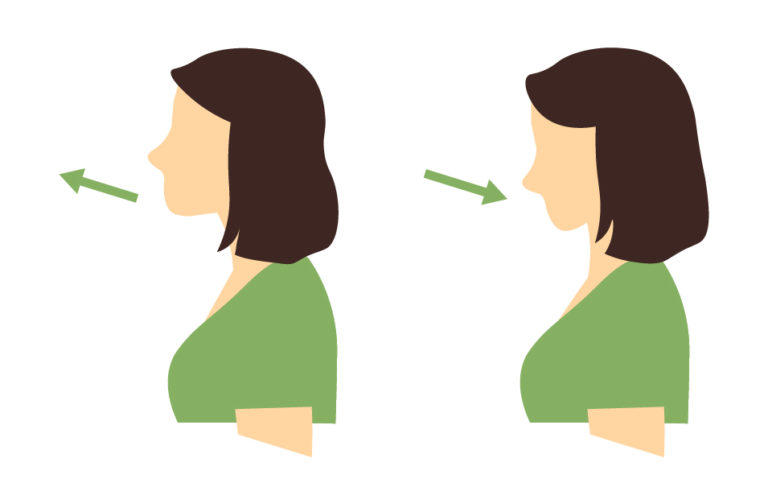 9 Bài Tập Đau Cổ Vai Gáy Hiệu Quả Áp Dụng Tại Nhà 4