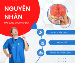 Đau Lưng Dưới: Nguyên Nhân, Triệu Chứng, Cách Trị Tại Nhà 69