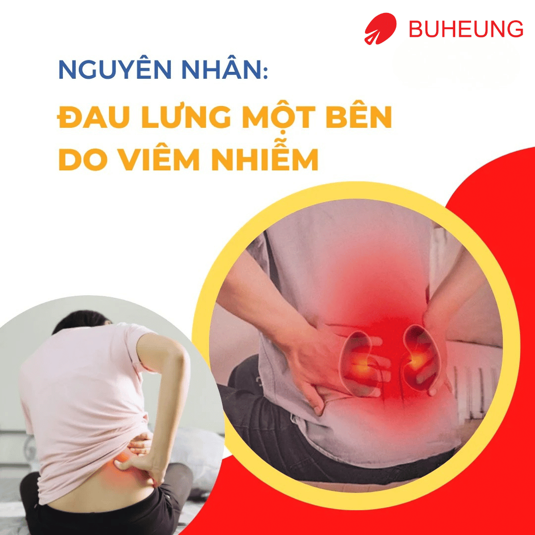 5 Nguyên Nhân Gây Đau Lưng Một Bên: Đau Lưng Bên Phải, Bên Trái 3