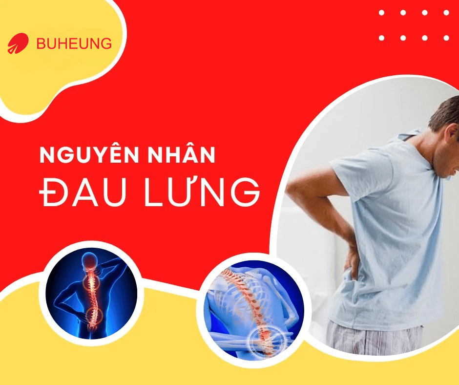 Đau lưng: Nguyên Nhân, Triệu Chứng, Trị Đau Lưng Tại Nhà 2