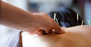 Châm Cứu Bấm Huyệt Là Gì: Công Dụng, Nhược Điểm 13