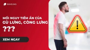 Mối Nguy Tiềm Ẩn Của Gù Lưng, Cong Lưng 2
