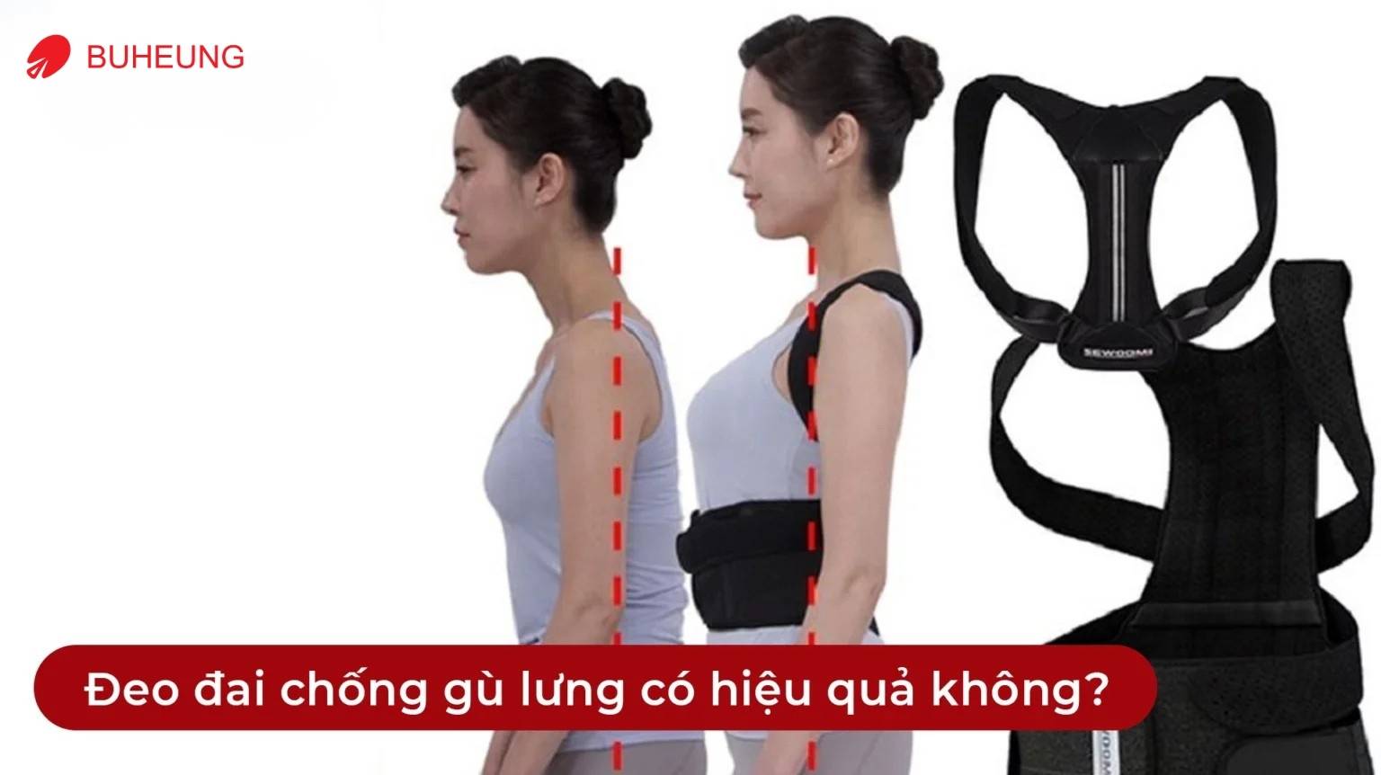 Đeo Đai Chống Gù Lưng Có Chữa Gù Lưng Được Không? 4