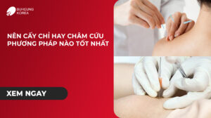 Minh họa phương pháp châm cứu và cấy chỉ