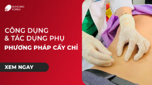Minh họa công dụng và tác dụng phụ của cấy chỉ