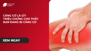 Minh họa căng cơ là gì và triệu chứng căng cơ
