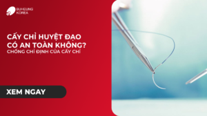 Minh họa cấy chỉ an toàn không và trường hợp chống chỉ định
