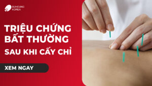 Minh họa triệu chứng bất thường sau cấy chỉ