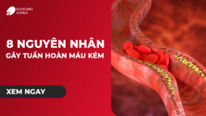 Minh họa 8 nguyên nhân tuần hoàn máu kém