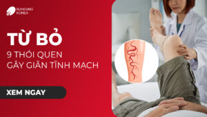 Từ Bỏ 9 Thói Quen Gây Giãn Tĩnh Mạch Chân 48