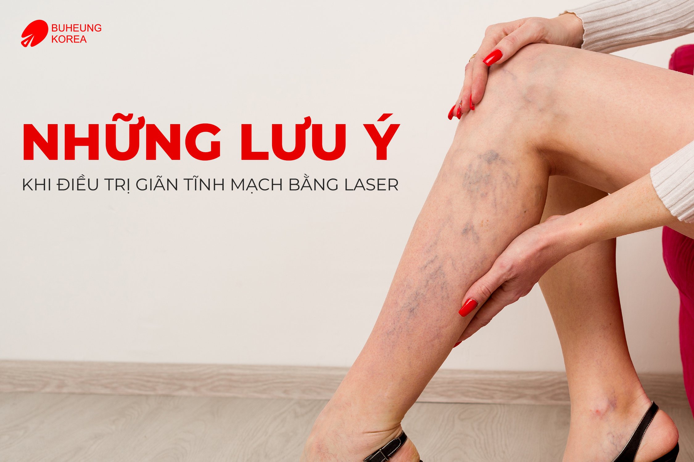 Chi Phí Điều Trị Giãn Tĩnh Mạch Bằng Laser 5