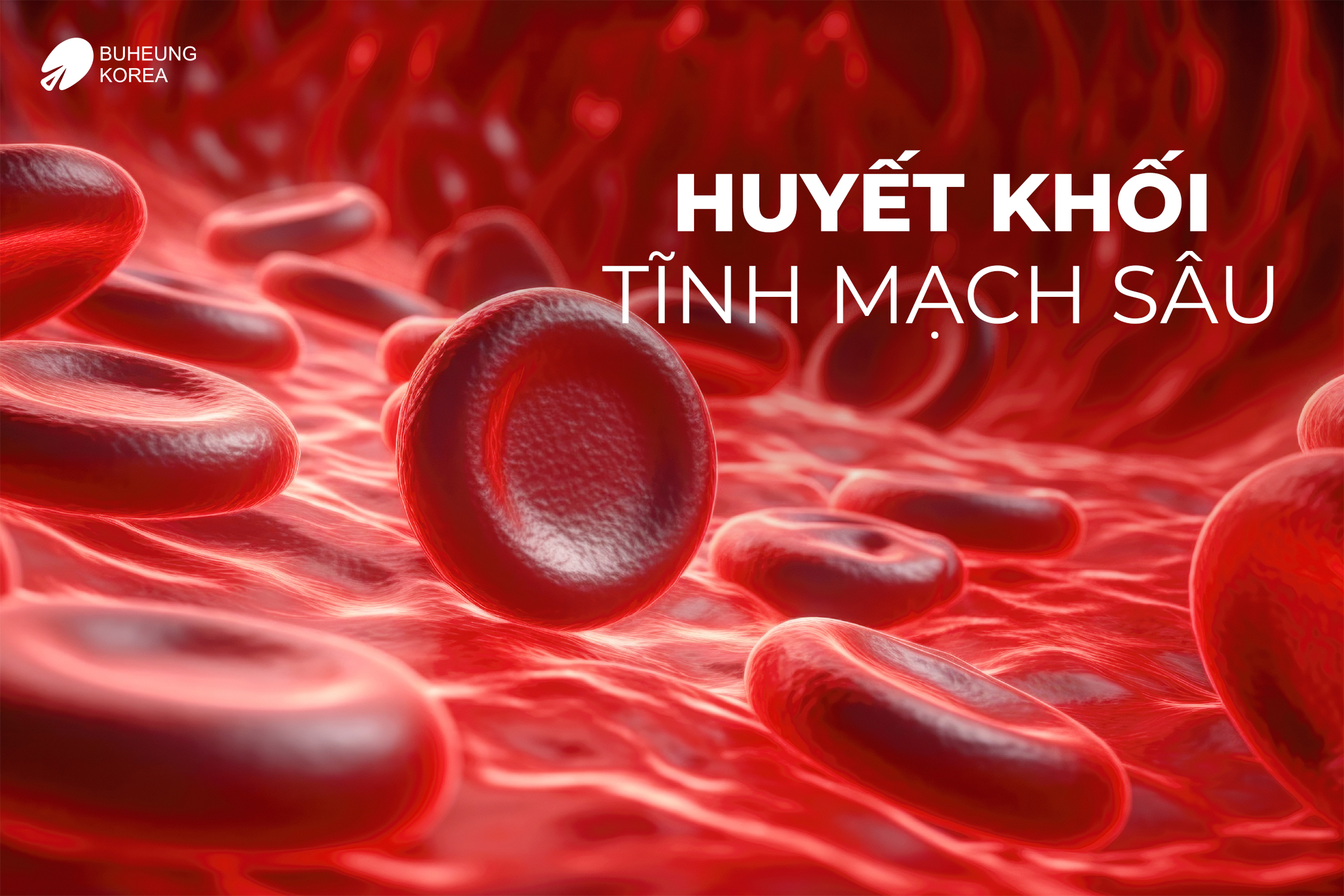 Giãn Tĩnh Mạch Bàn Chân Có Nguy Hiểm Không? 3