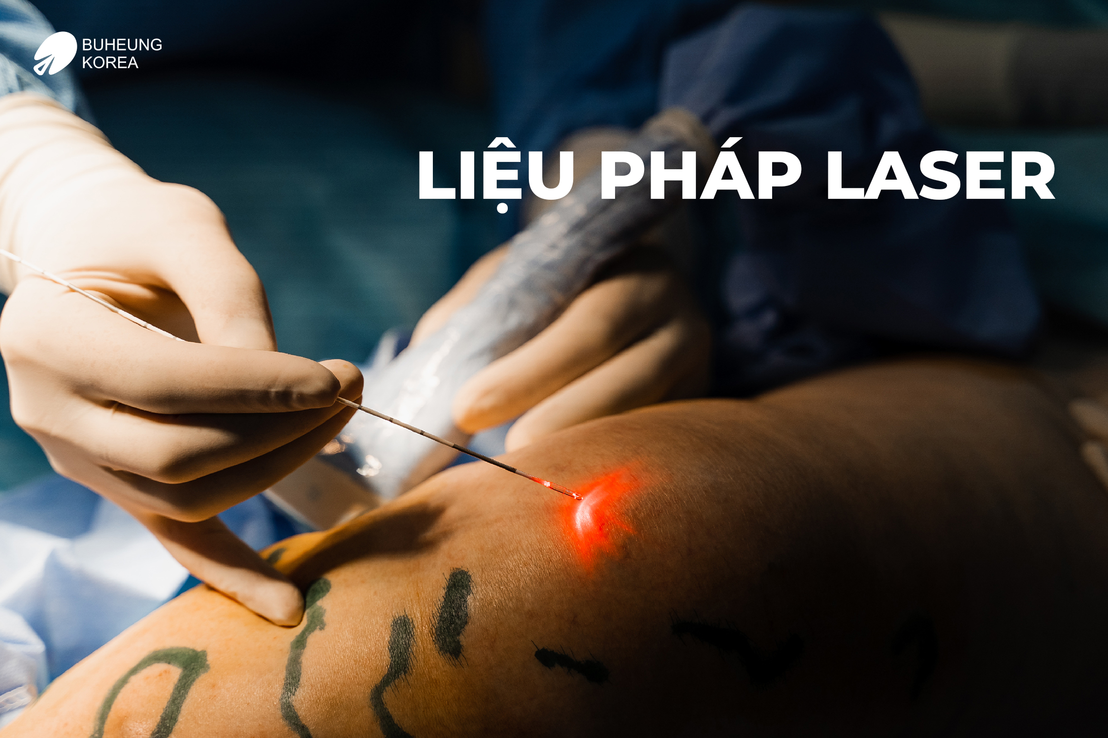 Giãn Tĩnh Mạch Bàn Chân Có Nguy Hiểm Không? 7