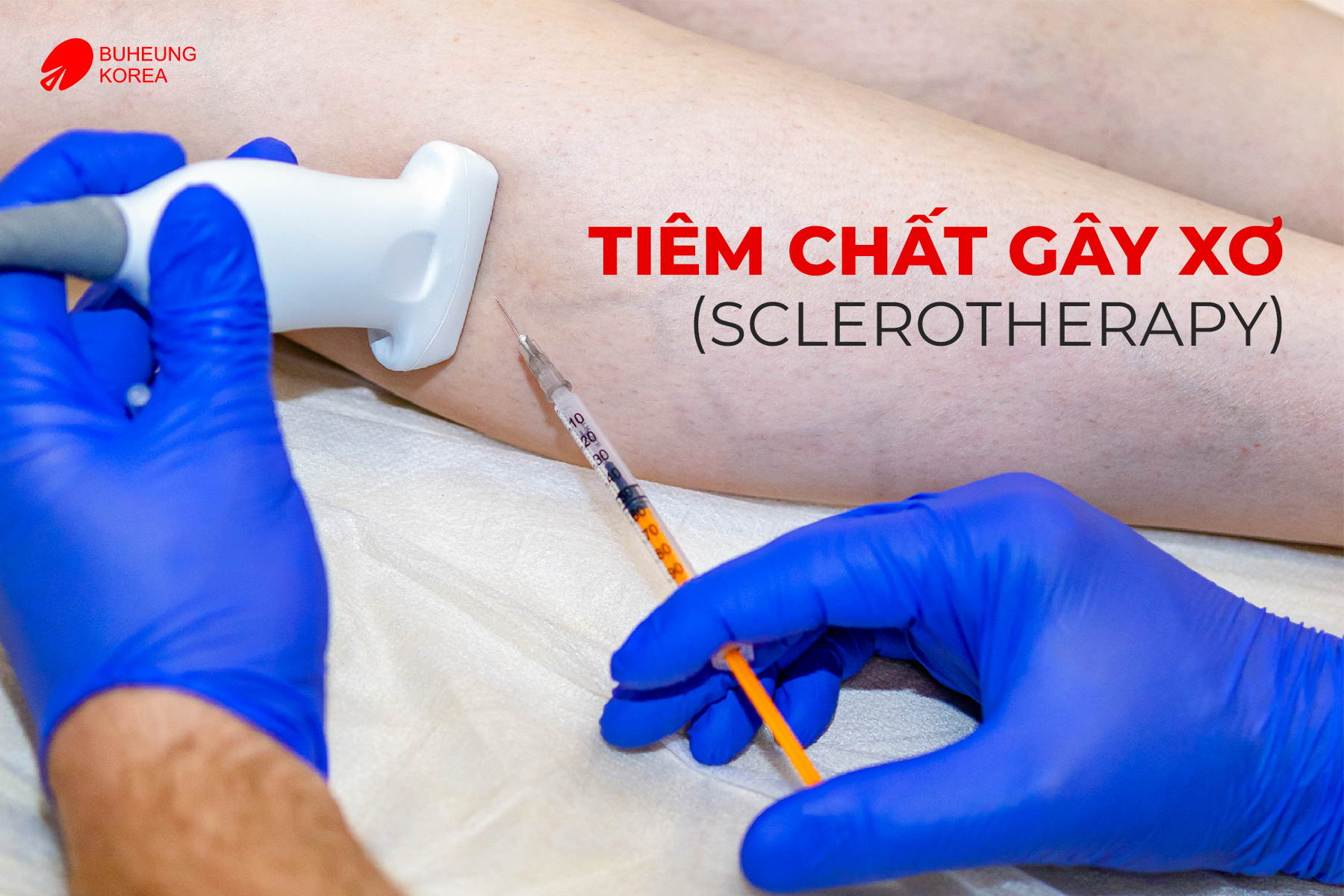 Giãn Tĩnh Mạch Bàn Chân Có Nguy Hiểm Không? 8