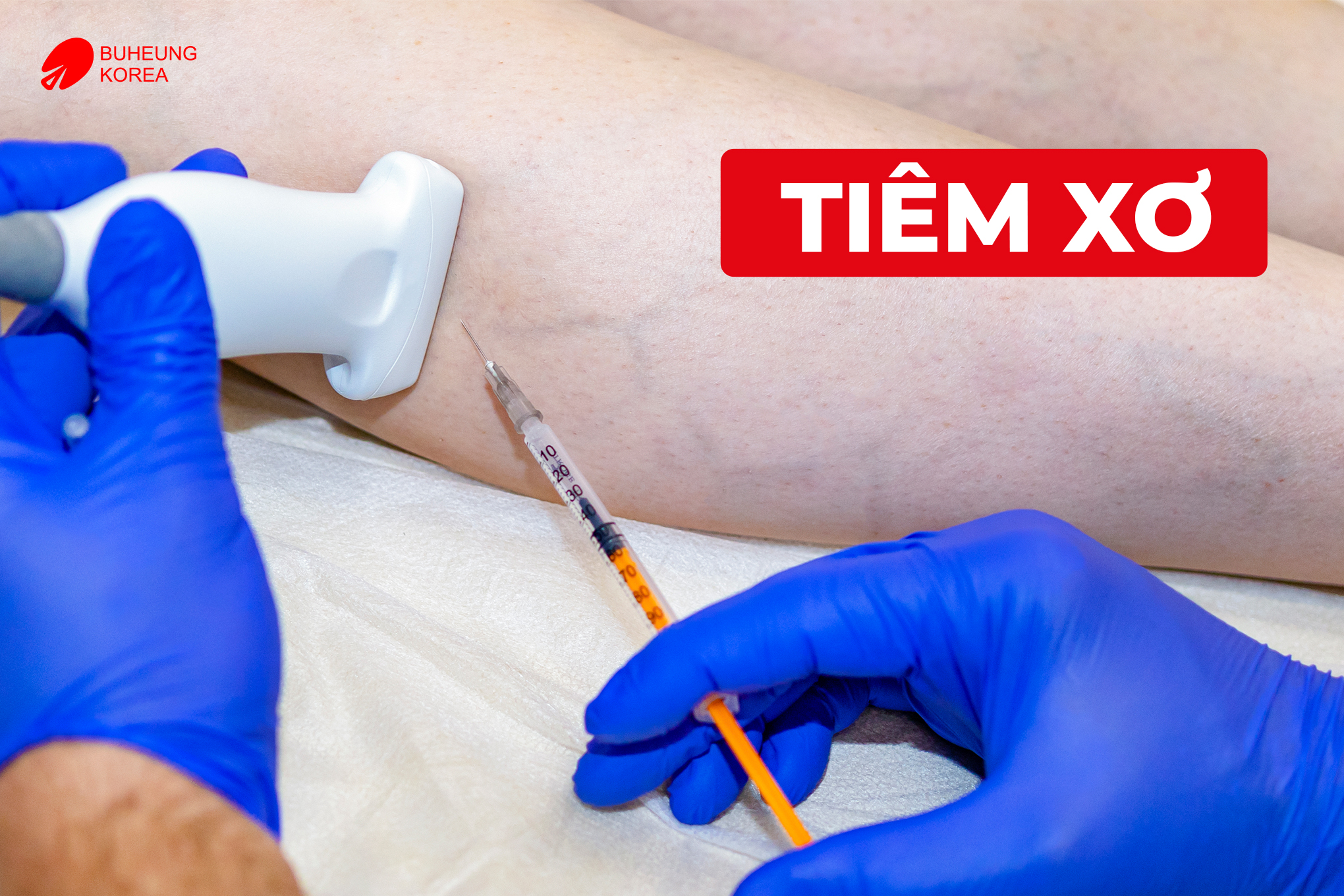 Giãn Tĩnh Mạch Chi Dưới Có Chữa Được Không? 3