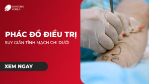 Phác Đồ Điều Trị Giãn Tĩnh Mạch Chi Dưới 83