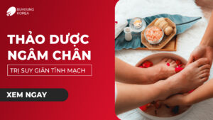 Top 5 Thảo Dược Ngâm Chân Trị Suy Giãn Tĩnh Mạch 91