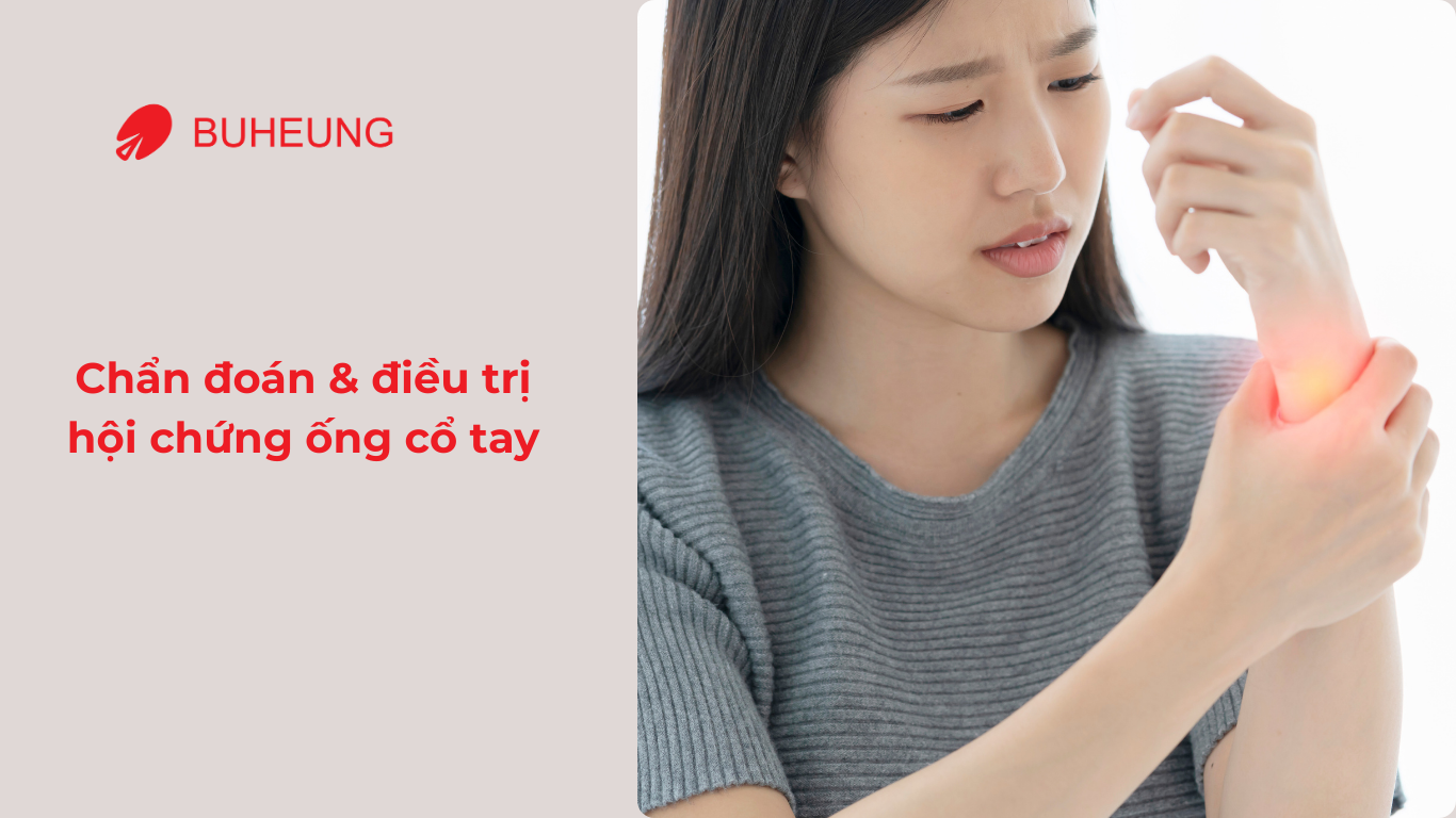 Hội Chứng Ống Cổ Tay Ở Dân Văn Phòng Là Gì? 4 Hội Chứng Ống Cổ Tay Ở Dân Văn Phòng Là Gì? 4