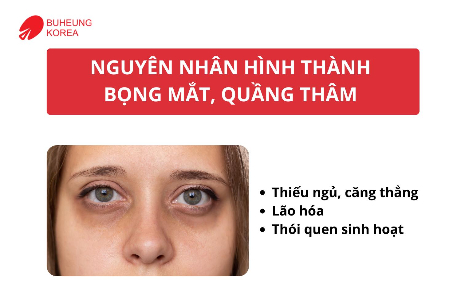 Cách Giảm Bọng Mắt, Quầng Thâm Bằng Massage Đầu Và Thái Dương 23