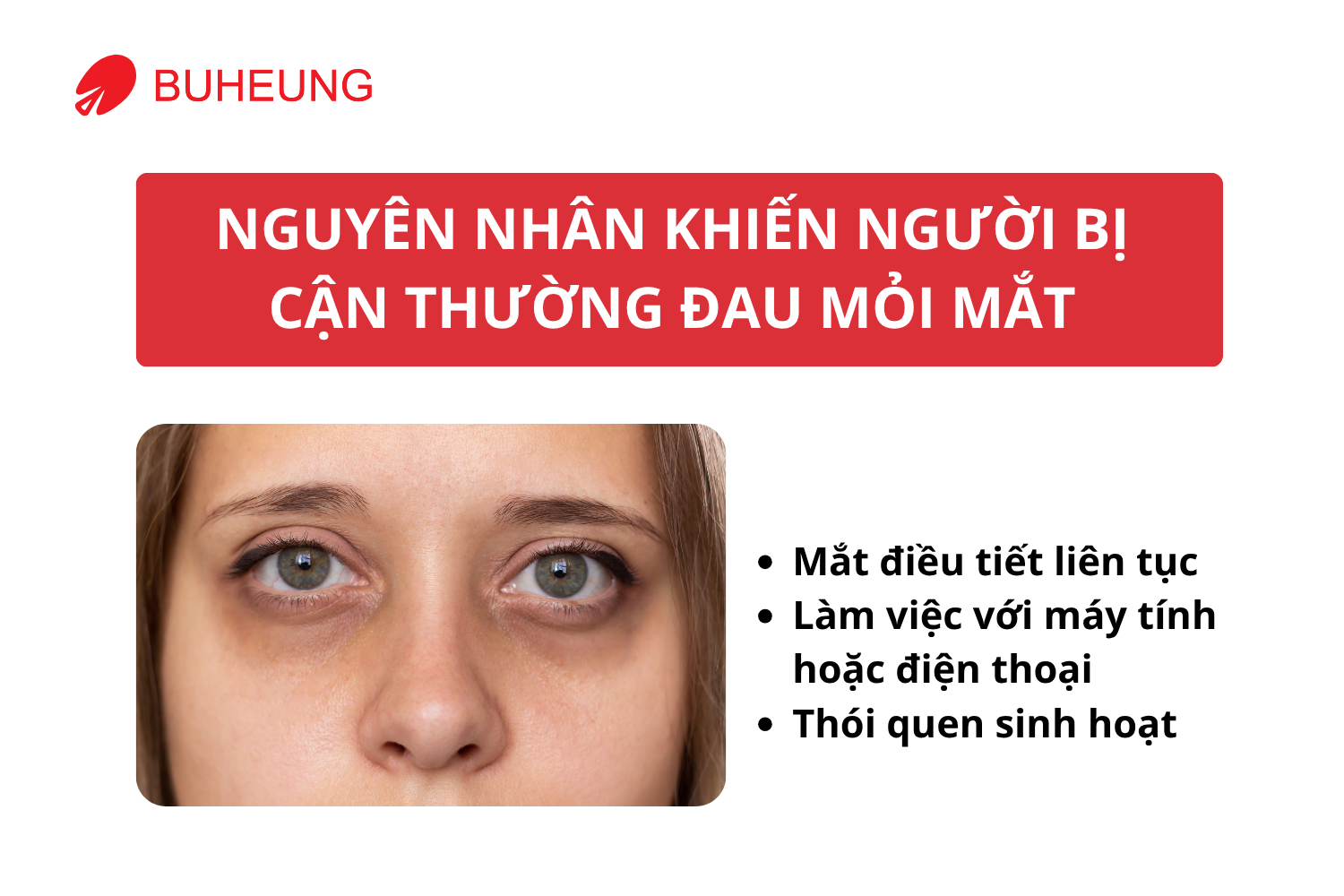 Người Bị Cận Nên Chăm Sóc Đôi Mắt Như Thế Nào Để Giảm Đau Mỏi 1 Người Bị Cận Nên Chăm Sóc Đôi Mắt Như Thế Nào Để Giảm Đau Mỏi 1