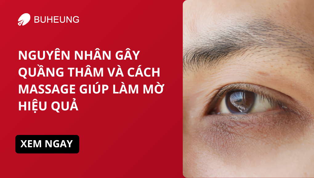 Nguyên Nhân Gây Quầng Thâm Và Cách Massage Giúp Làm Mờ Hiệu Quả 3 cách giảm quầng thâm hiệu quả