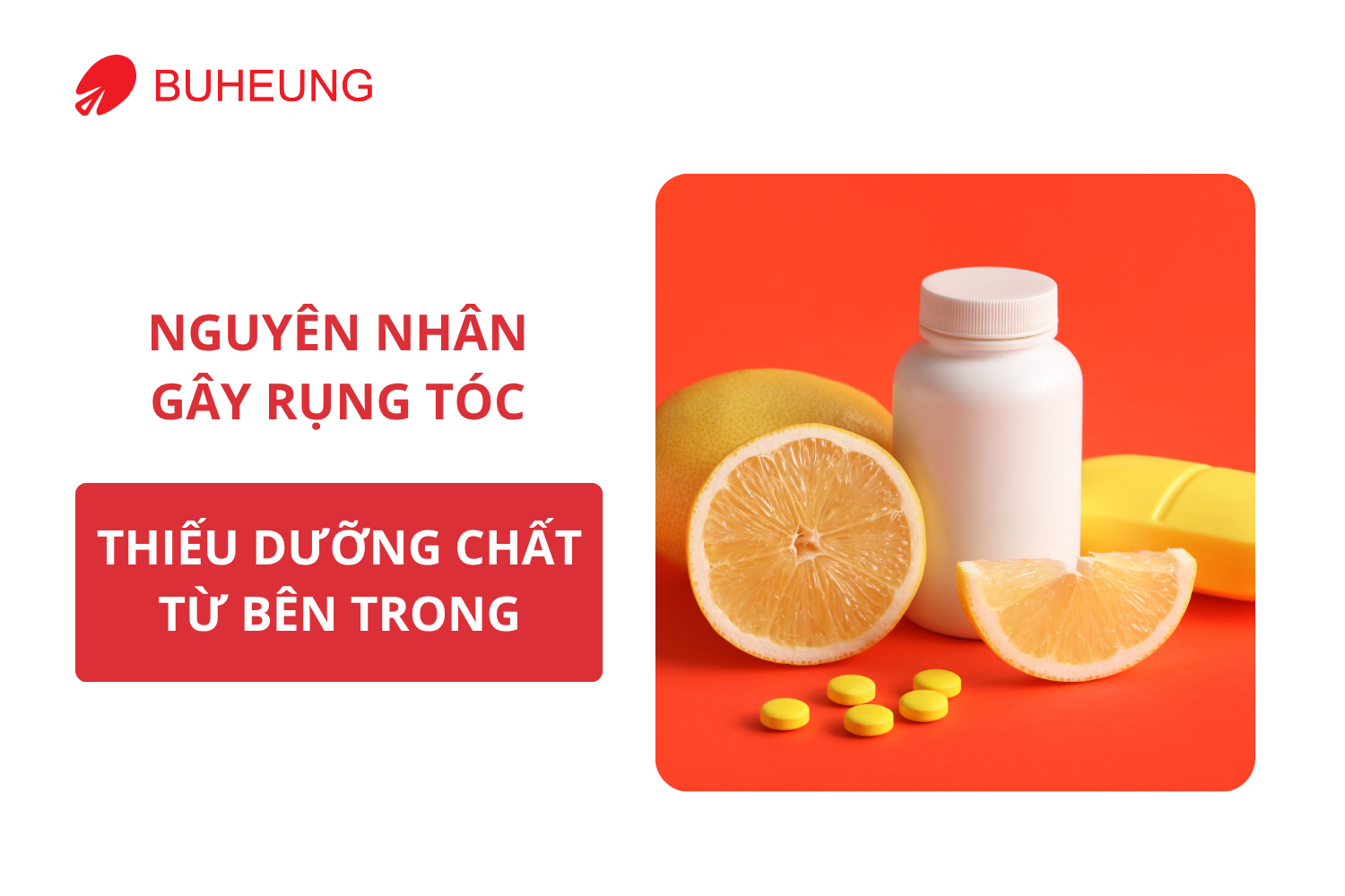7 Nguyên Nhân Khiến Bạn Rụng Tóc Nhiều Mỗi Ngày 2 7 Nguyên Nhân Khiến Bạn Rụng Tóc Nhiều Mỗi Ngày 2